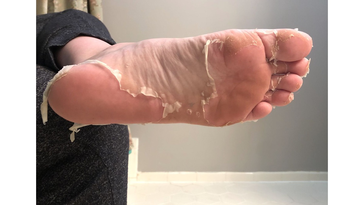 Foot-Peel-Mask